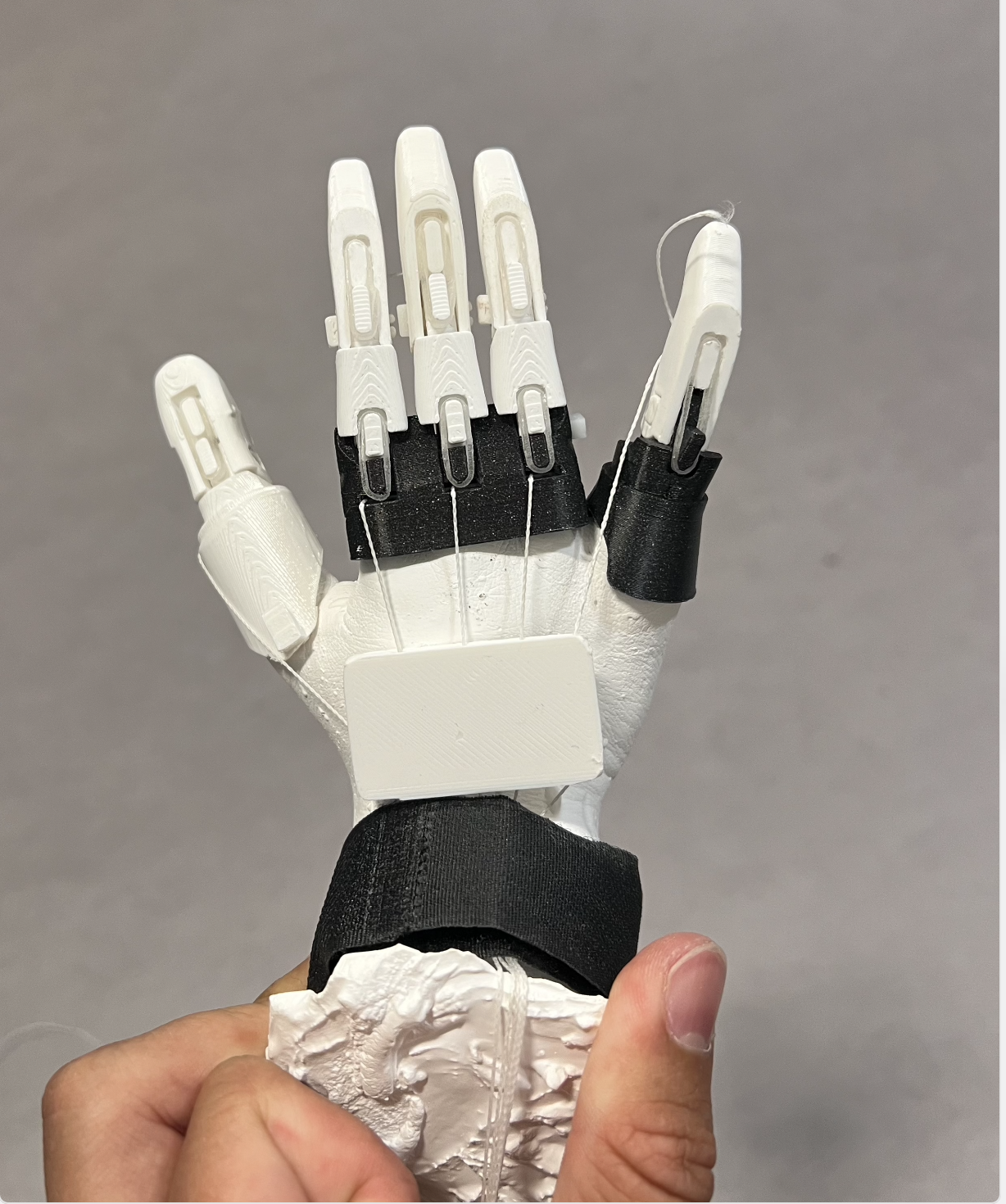 3D printed prosthetic hand